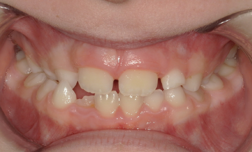 Before treatment