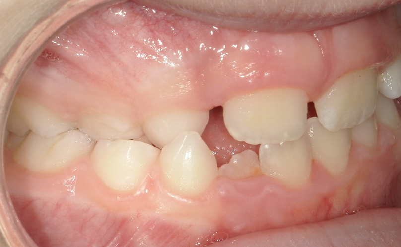 Before treatment