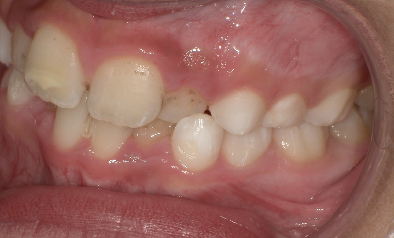 Before treatment