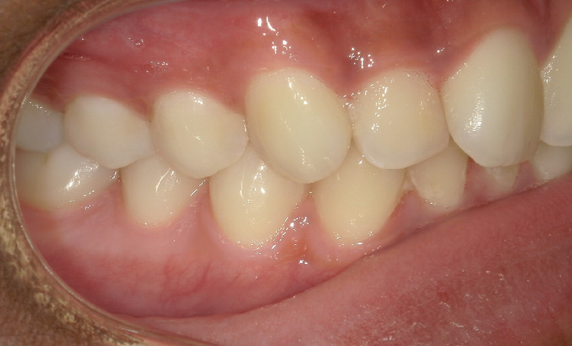 Before treatment