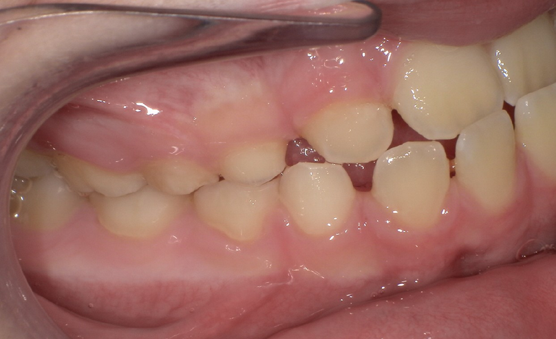 Before treatment