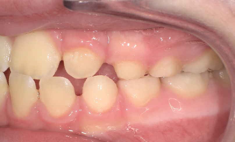 Before treatment