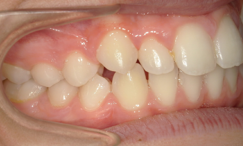 Before treatment