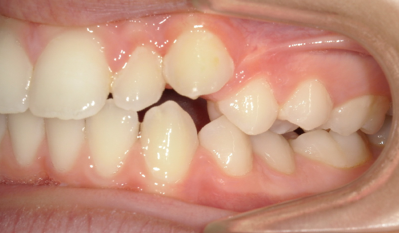 Before treatment