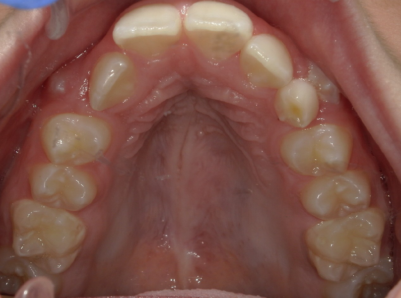 Before treatment