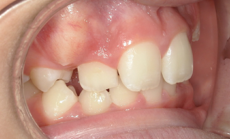 Before treatment
