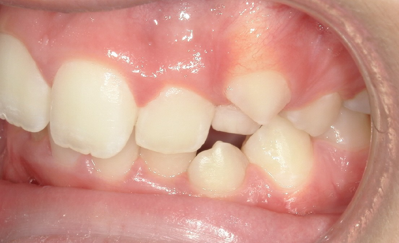 Before treatment