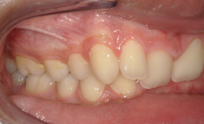 Before treatment